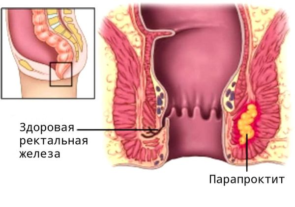 Ограничение доступа