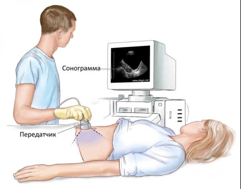 Преимущества диагностики брюшной полости методом ультразвука